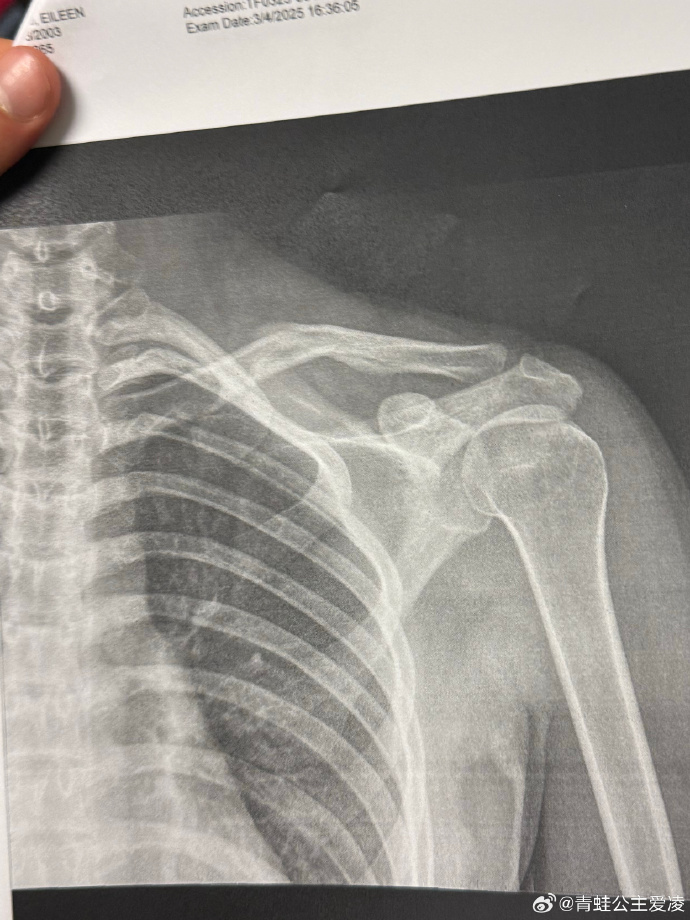 国加利福尼, 调整后, DzcNi 国加利福尼, 调整后, DzcNi